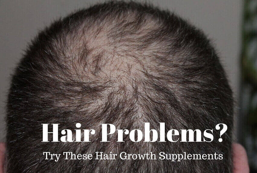 Hair-loss